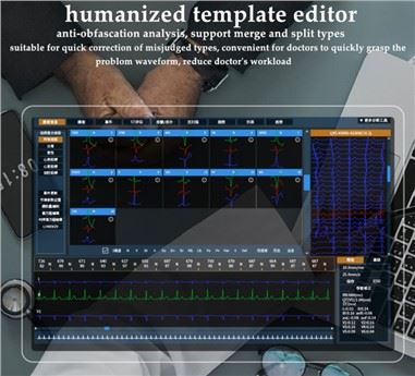 Sistema de monitoratge ECG Holter